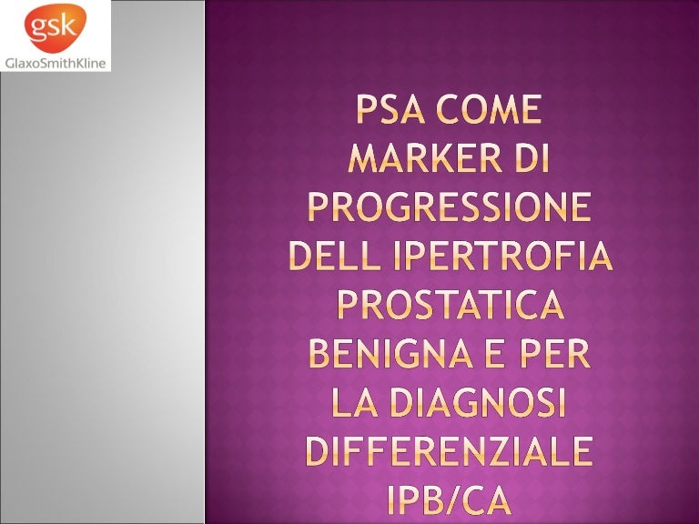 corrente su dht per il cancro alla prostata
